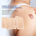 Puriderma Medical - Hojas de silicona para eliminar cicatrices (5 unidades) – Rápido y eficaz en queloides, cirugía, quemaduras, acné, cicatrices de sección C