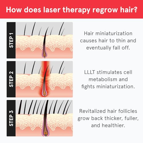 iRestore Laser Hair Growth System - FDA-Cleared Hair Loss Treatment & Treats Balding, Thinning Hair for Men and Women - Laser Hair Restoration Therapy Improves Hair Thickness, Volume, and Density by iRestore